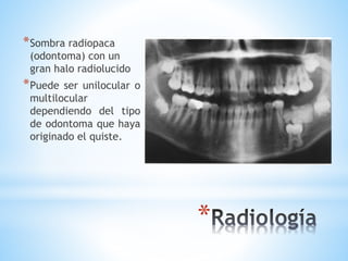 *
*Sombra radiopaca
(odontoma) con un
gran halo radiolucido
*Puede ser unilocular o
multilocular
dependiendo del tipo
de odontoma que haya
originado el quiste.
 