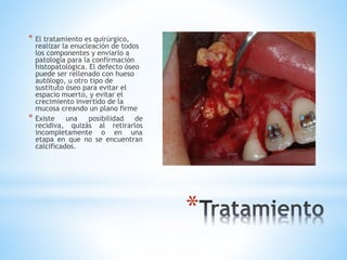 *
* El tratamiento es quirúrgico,
realizar la enucleación de todos
los componentes y enviarlo a
patología para la confirmación
histopatológica. El defecto óseo
puede ser rellenado con hueso
autólogo, u otro tipo de
sustituto óseo para evitar el
espacio muerto, y evitar el
crecimiento invertido de la
mucosa creando un plano firme
* Existe una posibilidad de
recidiva, quizás al retirarlos
incompletamente o en una
etapa en que no se encuentran
calcificados.
 