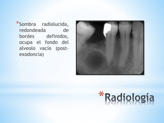 *
*Sombra radiolucida,
redondeada de
bordes definidos,
ocupa el fondo del
alveolo vacío (post-
exodoncia)
 