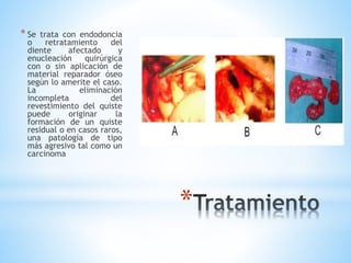 *
* Se trata con endodoncia
o retratamiento del
diente afectado y
enucleación quirúrgica
con o sin aplicación de
material reparador óseo
según lo amerite el caso.
La eliminación
incompleta del
revestimiento del quiste
puede originar la
formación de un quiste
residual o en casos raros,
una patología de tipo
más agresivo tal como un
carcinoma
 