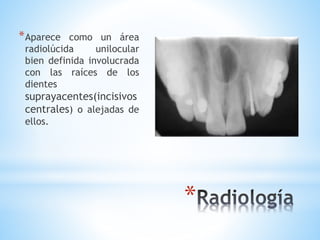 *
*Aparece como un área
radiolúcida unilocular
bien definida involucrada
con las raíces de los
dientes
suprayacentes(incisivos
centrales) o alejadas de
ellos.
 