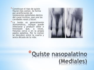 *
* Constituye el tipo de quiste
fisural más común. Se forma
por proliferación de
remanentes epiteliales dentro
del canal incisivo, que une las
cavidades nasal y bucal.
* La lesión es generalmente
asintomática, aunque puede
infectarse y producir dolor e
hinchazón que, a veces,
fistuliza cerca o en la propia
papila palatina. Por lo común
se descubre entre la cuarta y
sexta década de la vida.
 