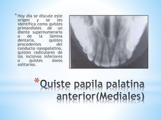 *
*Hoy día se discute este
origen y se les
identifica como quistes
primordiales de un
diente supernumerario
o de la lámina
dentaria, quistes
procedentes del
conducto nasopalatino,
quistes radiculares de
los incisivos inferiores
o quistes óseos
solitarios.
 