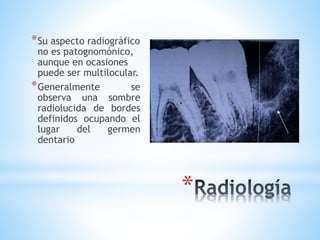 *
*Su aspecto radiográfico
no es patognomónico,
aunque en ocasiones
puede ser multilocular.
*Generalmente se
observa una sombre
radiolucida de bordes
definidos ocupando el
lugar del germen
dentario
 
