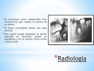 *
*Se presentan como radiolucidez bien
circunscritas que rodean la corona de
un diente.
*El hueso circundante posee una capa
cortical.
*Este quiste puede desplazar al diente
asociado en dirección caudal en
mandíbula y en el maxilar hacia arriba
y hacia atrás.
 