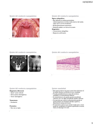13/10/2012
9
Quiste del conducto nasopalatino Quiste del conducto nasopalatino
Signos radiográficos
 Bien definidos,la mediana-paramediana
radiotransparencia en la línea media anterior del maxilar,
mayor que 5 a 6 mm de diámetro
 Bordes generalmente escleróticos
 Redondo,ovalado o en forma de corazón
Diagnóstico
 Características radiográficas
 Biopsia de confirmación
Quiste del conducto nasopalatino Quiste del conducto nasopalatino
Quiste del conducto nasopalatino
Diagnóstico diferencial
 Apical / quiste radicular
 Otros quistes odontogénicos
 Tumor odontogénico
Tratamiento
 Enucleación
Pronóstico
 Rara vez se repite
Quiste nasolabial
 Este quiste se forma muy poco común fuera del hueso en
los tejidos blandos y profundos al surco nasolabial.
 Procede probablemente de restos del conducto
nasolabial y es ocasionalmente bilateral.
 Es revestimiento es de epitelio pesudo-estratificado
columnar con o sin algún estratificado epitelio columnar.
 Si se permite que crezca lo suficientemente grande, el
quiste produce una hinchazón del labio superior y
distorsiona la ventana de la nariz.
 El tratamiento suele ser por escisión simple, pero a veces
puede ser complicado si el quiste ha perforado la mucosa
nasal y se descarga en la nariz.
 