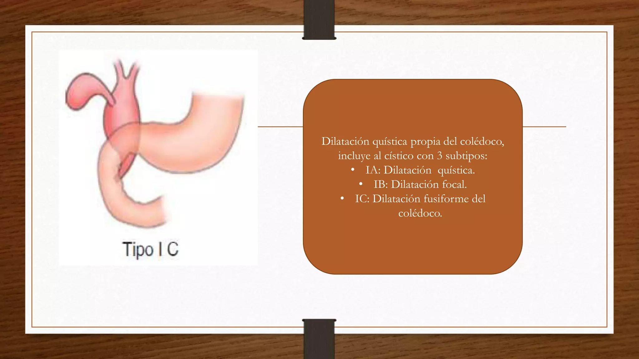 QUISTES DE COLEDOCO.pptx