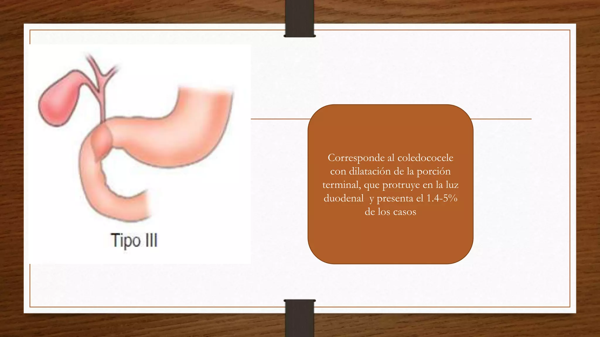 QUISTES DE COLEDOCO.pptx