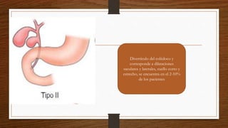 QUISTES DE COLEDOCO.pptx