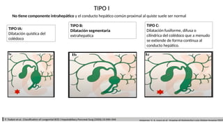 Quistes de coledoco Diagnóstico y tratamiento.pptx