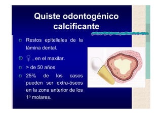 Quistes de la region maxilofacial