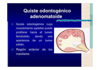 Quistes de la region maxilofacial