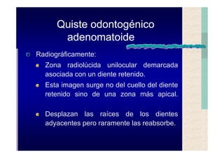 Quistes de la region maxilofacial