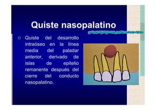 Quistes de la region maxilofacial