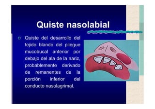Quistes de la region maxilofacial