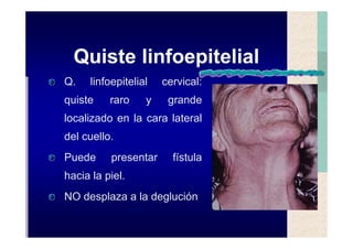 Quistes de la region maxilofacial