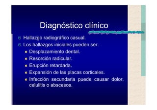Quistes de la region maxilofacial