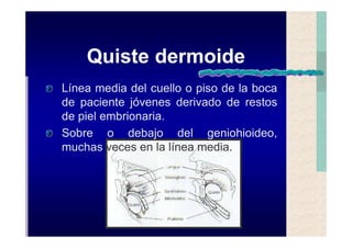 Quistes de la region maxilofacial