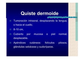 Quistes de la region maxilofacial