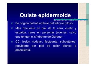 Quistes de la region maxilofacial