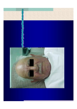 Quistes de la region maxilofacial