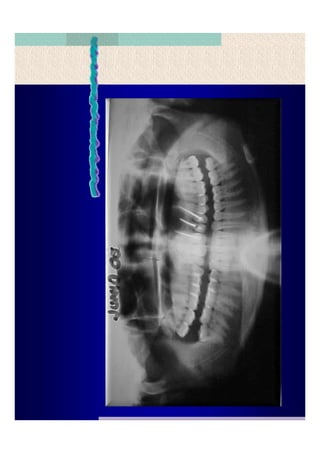 Quistes de la region maxilofacial