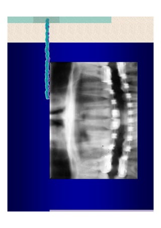 Quistes de la region maxilofacial