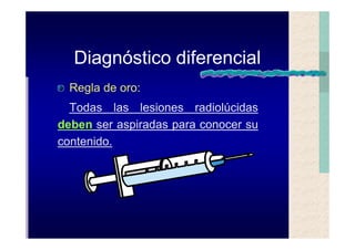 Quistes de la region maxilofacial