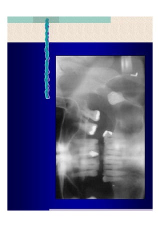 Quistes de la region maxilofacial