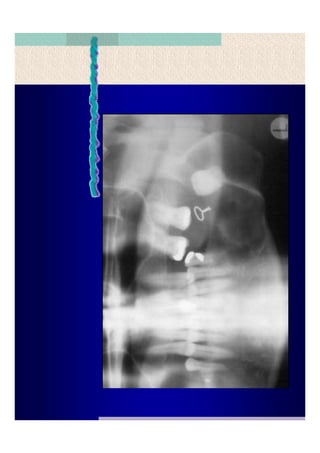 Quistes de la region maxilofacial