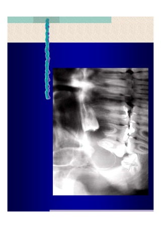 Quistes de la region maxilofacial