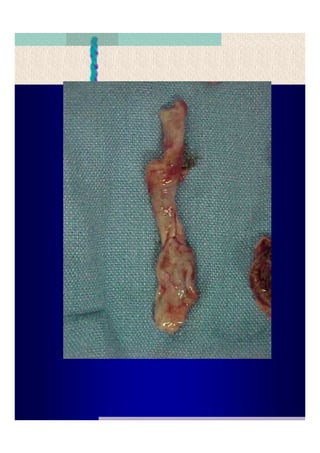 Quistes de la region maxilofacial
