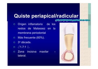 Quistes de la region maxilofacial
