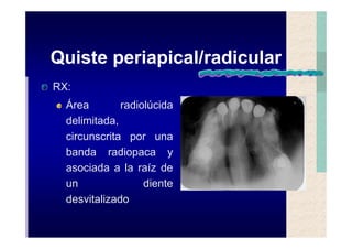 Quistes de la region maxilofacial