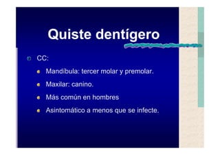Quistes de la region maxilofacial