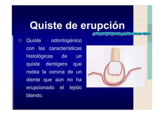 Quistes de la region maxilofacial