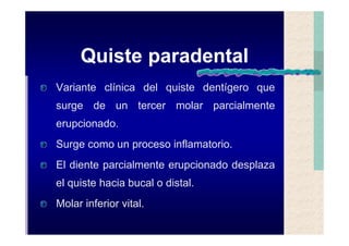 Quistes de la region maxilofacial