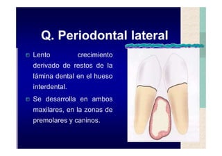 Quistes de la region maxilofacial