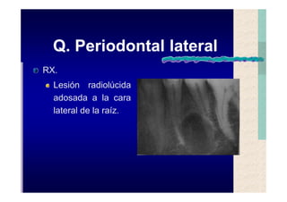 Quistes de la region maxilofacial