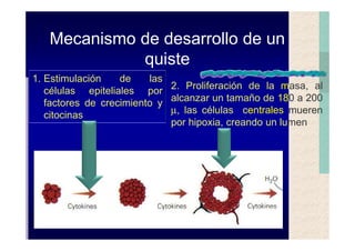 Quistes de la region maxilofacial