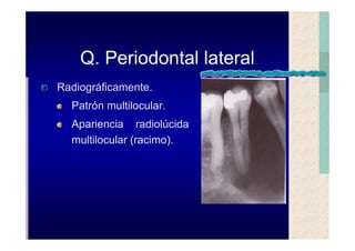 Quistes de la region maxilofacial