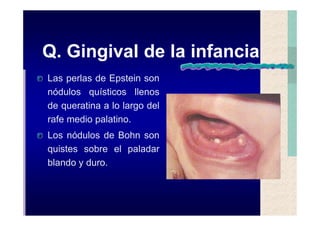 Quistes de la region maxilofacial