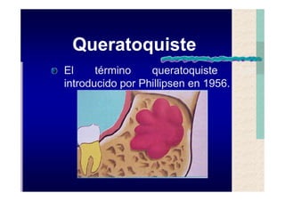 Quistes de la region maxilofacial