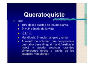 Quistes de la region maxilofacial