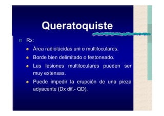 Quistes de la region maxilofacial