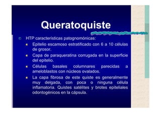 Quistes de la region maxilofacial