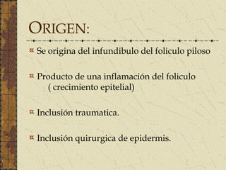 ORIGEN:
Se origina del infundibulo del foliculo piloso

Producto de una inflamación del foliculo
  ( crecimiento epitelial)

Inclusión traumatica.

Inclusión quirurgica de epidermis.
 