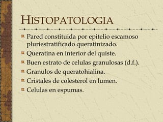 HISTOPATOLOGIA
Pared constituida por epitelio escamoso
pluriestratificado queratinizado.
Queratina en interior del quiste.
Buen estrato de celulas granulosas (d.f.).
Granulos de queratohialina.
Cristales de colesterol en lumen.
Celulas en espumas.
 