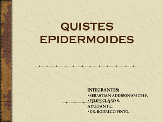 QUISTES
EPIDERMOIDES



      INTEGRANTES:
      •SEBASTIAN ADDISON-SMITH F.
      •FELIPE CLARO S.
      AYUDANTE:
      •DR. RODRIGO PINTO.
 