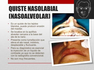 QUISTE NASOLABIAL
(NASOALVEOLAR)
• Es un quiste de los tejidos
blandos, puede producir erosión
del maxilar.
• Se localiza en la apófisis
alveolar cercana a la base del
ala de la nariz.
• Presenta como tumefacción que
eleva el ala nasal, indolora,
desplazable y fluctuante.
• Para su diagnóstico es esencial
la inyección de un líquido de
contraste ya que no se detectan
con la radiografía convencional.
• No son muy frecuentes.
 